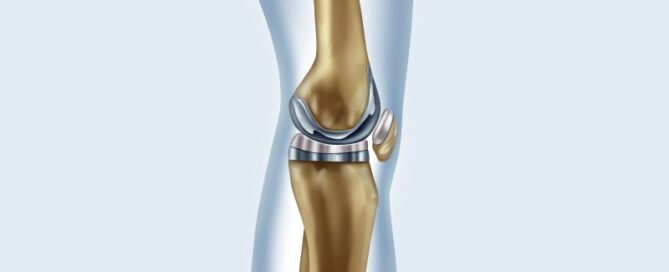 Rehabilitation bei einer Knieprothese